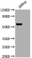 Nucleoprotein (N) of Novel Coronavirus SARS-CoV-2/ 2019-nCoV (human) in the group Antibodies for Human/Animal / Coronavirus Research at Agrisera AB (Antibodies for research) (AS20 4387)